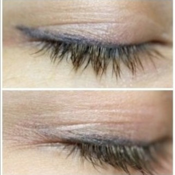 Удаление татуажа губ
                    Тату салон TST Киев