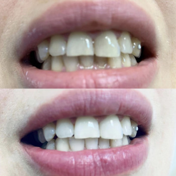 Вікторія Чернець, Одеса Фото - 5