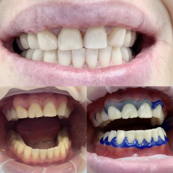 Вікторія Чернець, Одеса Фото - 6