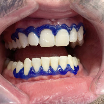 Вікторія Чернець, Одеса Фото - 7