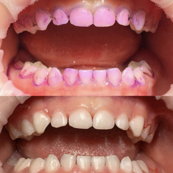 Вікторія Чернець, Одеса Фото - 8