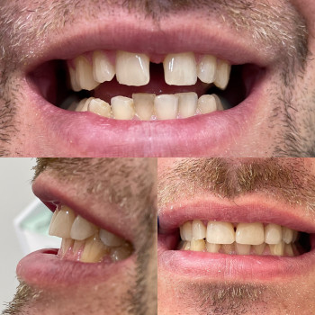 Вікторія Чернець, Одеса Фото - 9