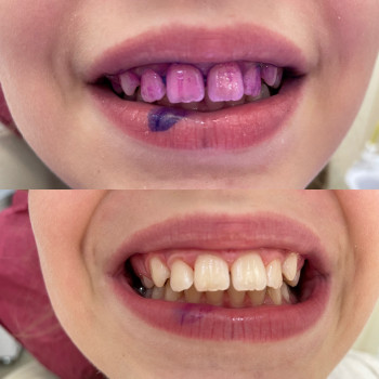 Вікторія Чернець, Одеса Фото - 10