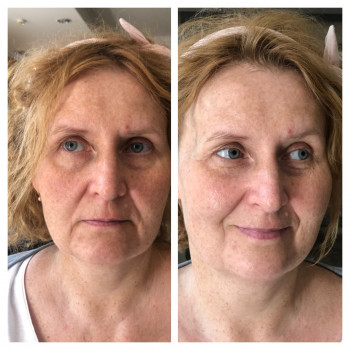 Уходовая процедура Forrled с массажем