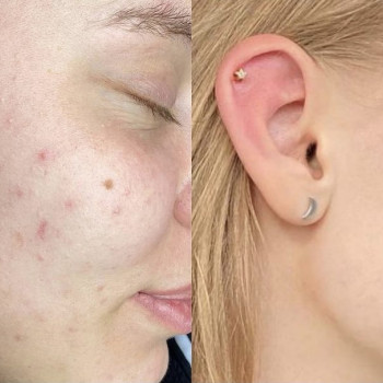 Владислава Линькевич, Одесса Фото - 5