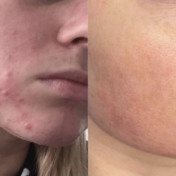 Владислава Линькевич, Одесса Фото - 6