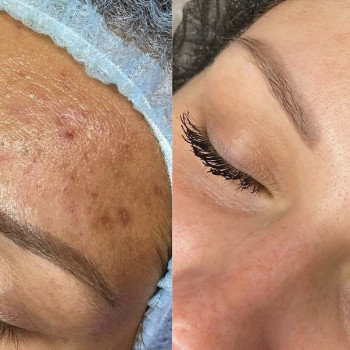 Владислава Линькевич, Одесса Фото - 7