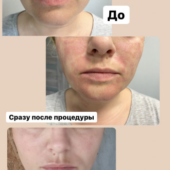 Наталія Бутенко, Полтава Фото - 13