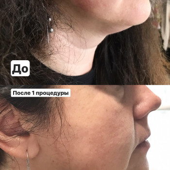 Наталія Бутенко, Полтава Фото - 14