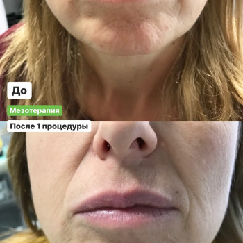 Наталія Бутенко, Полтава Фото - 16