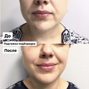 Наталія Бутенко, Полтава Фото - 17