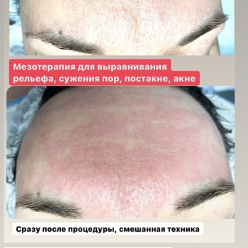 Наталія Бутенко, Полтава Фото - 19