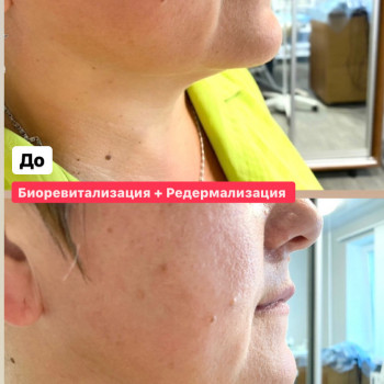 Наталія Бутенко, Полтава Фото - 20