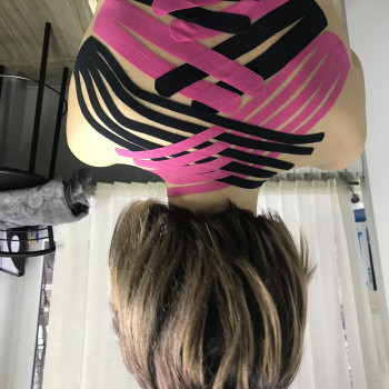 Терапевтическое тейпирование для снятия боли в спине.