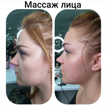 Лифтинговый массаж лица , это результат от 1 процедуры
