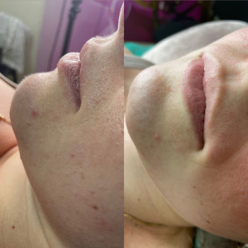 Анастасія Ярова, Харків Фото - 6