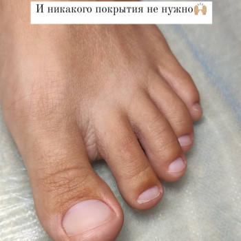 Подологический педикюр