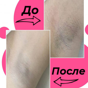 Комплекс лазерної епіляції №3 (глибоке бікіні + пахви+ гомілки + коліна + стегна частково + пальці на ногах по бажанню)
                    Салон красоты Мастерская Красоты "Юлии Юдиной" Киев