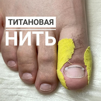 Корректирующая система