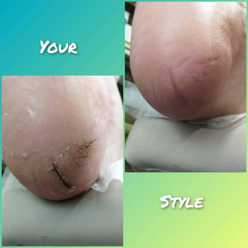 Надія Чечуй, Бровари Фото - 23