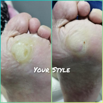 Надія Чечуй, Бровари Фото - 26