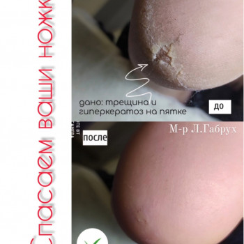 Педикюр апаратний
                    Салон краси Beauty Line Запоріжжя