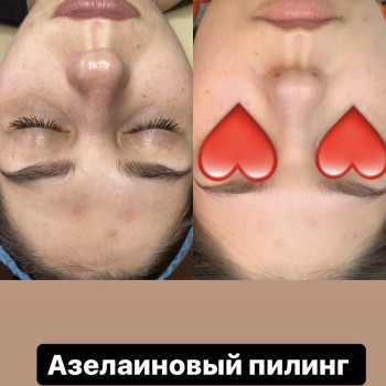 Дария Трегубенко, Киев Фото - 28