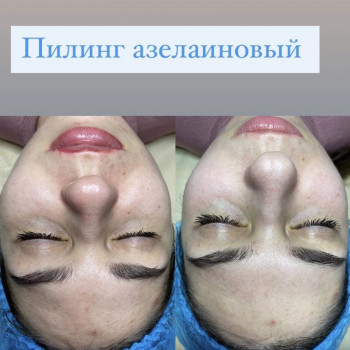 Дария Трегубенко, Киев Фото - 35