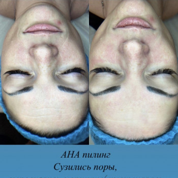 Дария Трегубенко, Киев Фото - 37