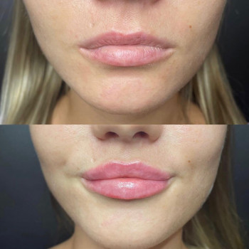 Дмитро Олександрович Канєвський, Київ Фото - 15