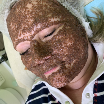 Маска «Живой коллаген»