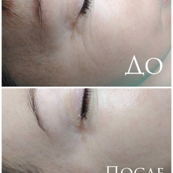 Янина Лебедь, Киев Фото - 5