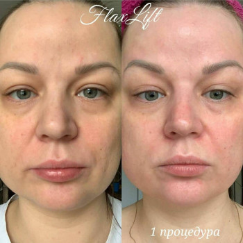 Lili, Нетешин Фото - 6