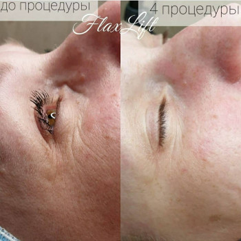 Lili, Нетешин Фото - 7