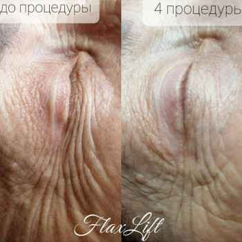 Lili, Нетешин Фото - 8