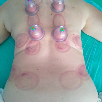 Баночный массаж
                    Массажист Юлія Киев