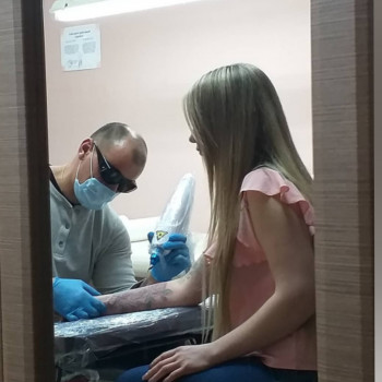 в процессе удаления тату