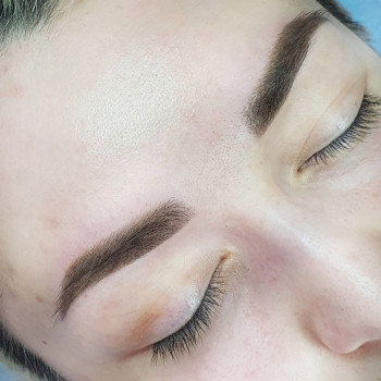 сразу после процедуры