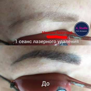 Лазерное удаление тату/татуажа
                    Мастер перманентного макияжа Анна Черкассы