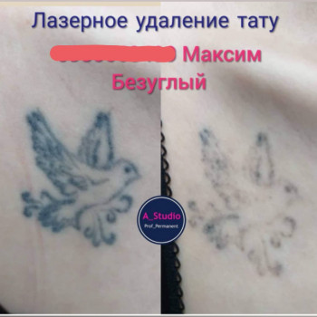 Лазерное удаление тату/татуажа
                    Мастер перманентного макияжа Анна Черкассы