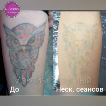 Лазерное удаление тату/татуажа
                    Мастер перманентного макияжа Анна Черкассы