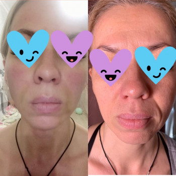 София Александрова, Одесса Фото - 13