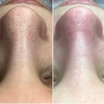 LoveLaser, Чернигов Фото - 7