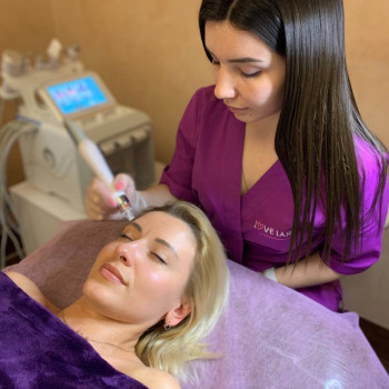 LoveLaser, Чернигов Фото - 3