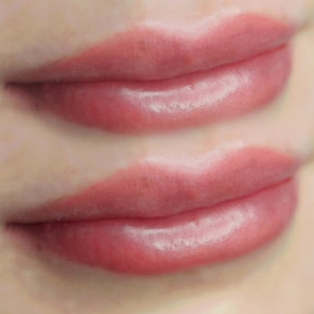 Саті Дем'ян, Черновцы Фото - 6