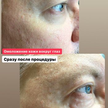 Наталія Бутенко, Полтава Фото - 43