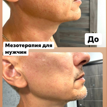 Наталія Бутенко, Полтава Фото - 45