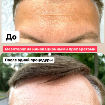 Наталія Бутенко, Полтава Фото - 48