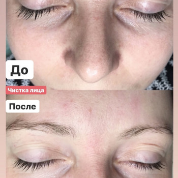 Наталія Бутенко, Полтава Фото - 49