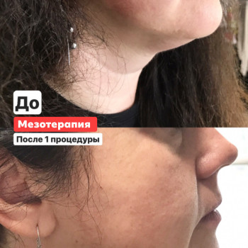 Наталія Бутенко, Полтава Фото - 50